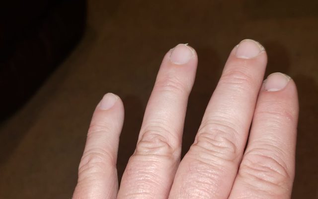 Are You a Man? Got a Short Ring Finger? You Better Read This